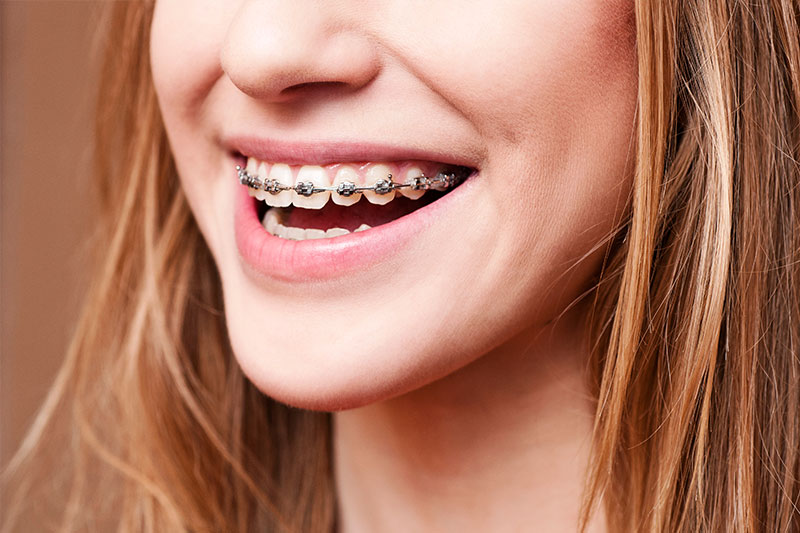 Orthodontics in Bridgeville